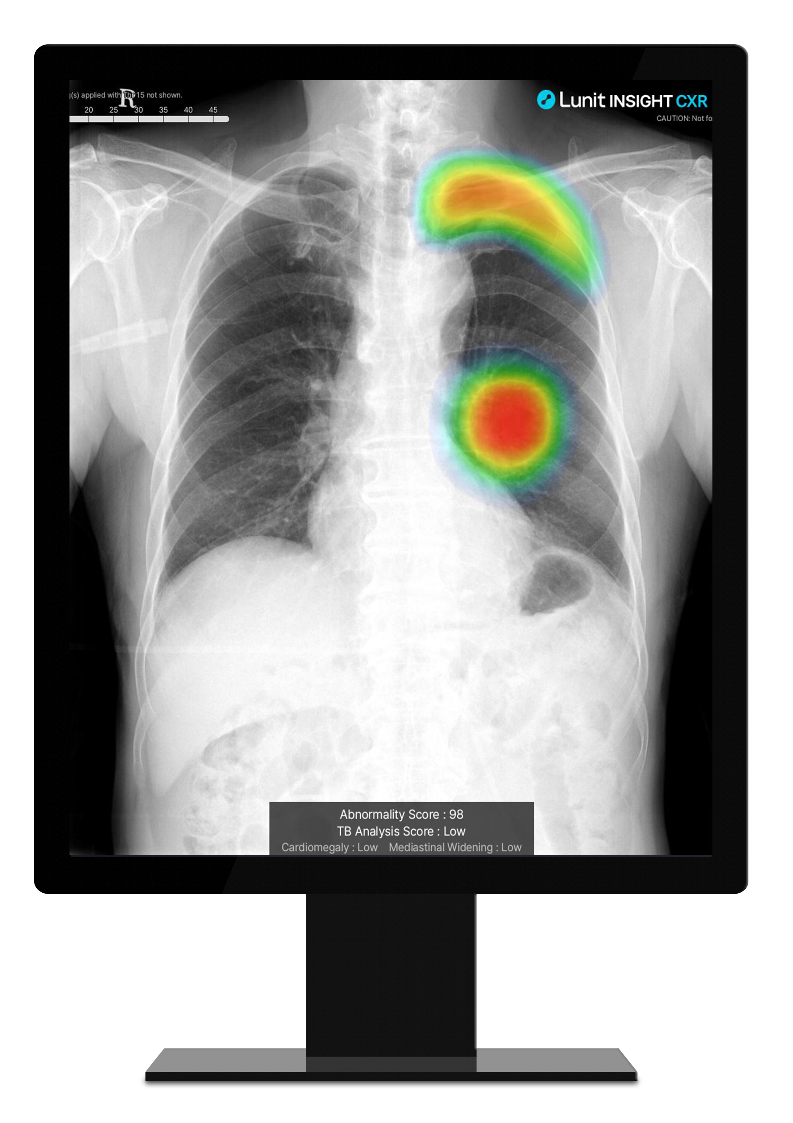 Lunit INSIGHT CXR monitor (subin)