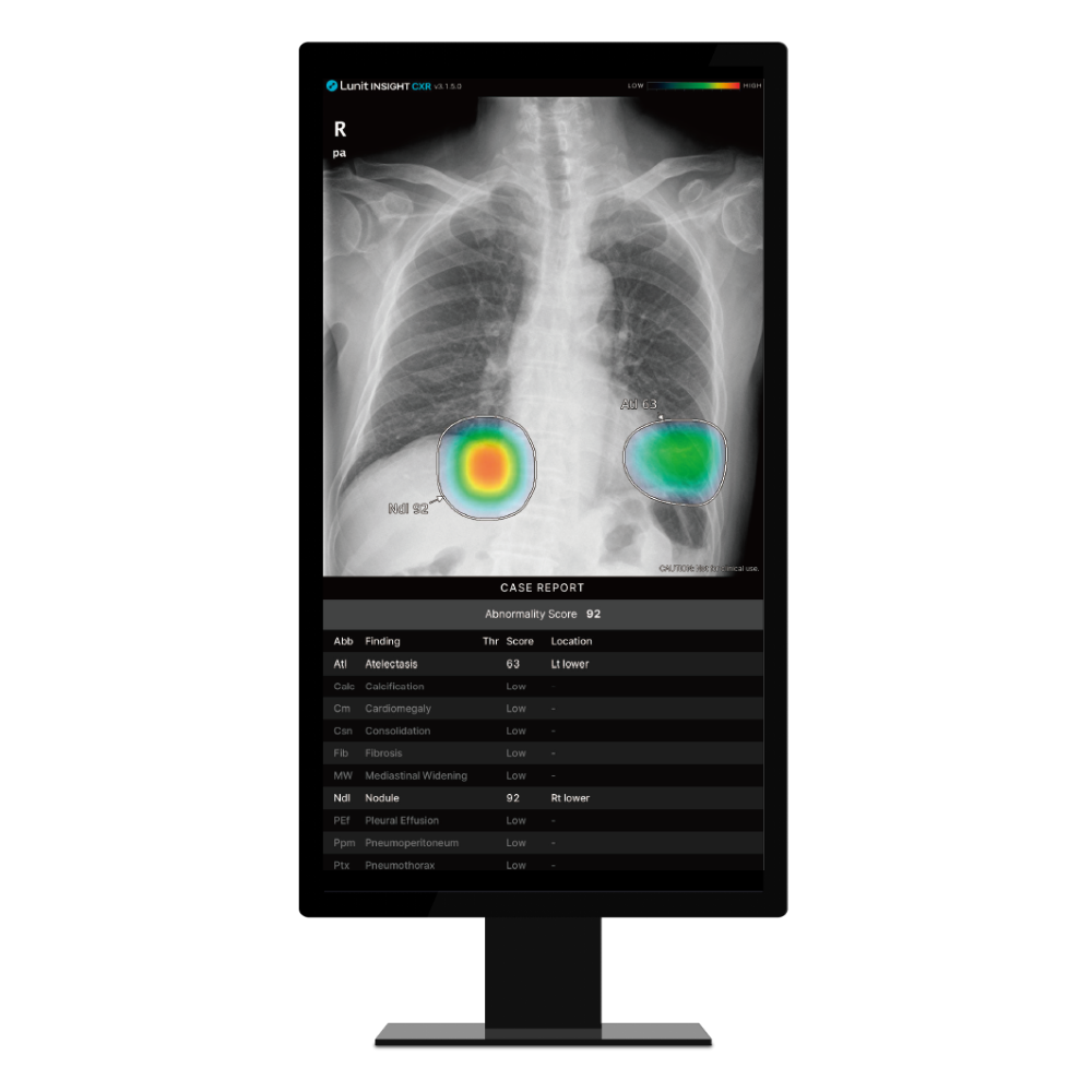 RSNA 2024_landing page_CXR