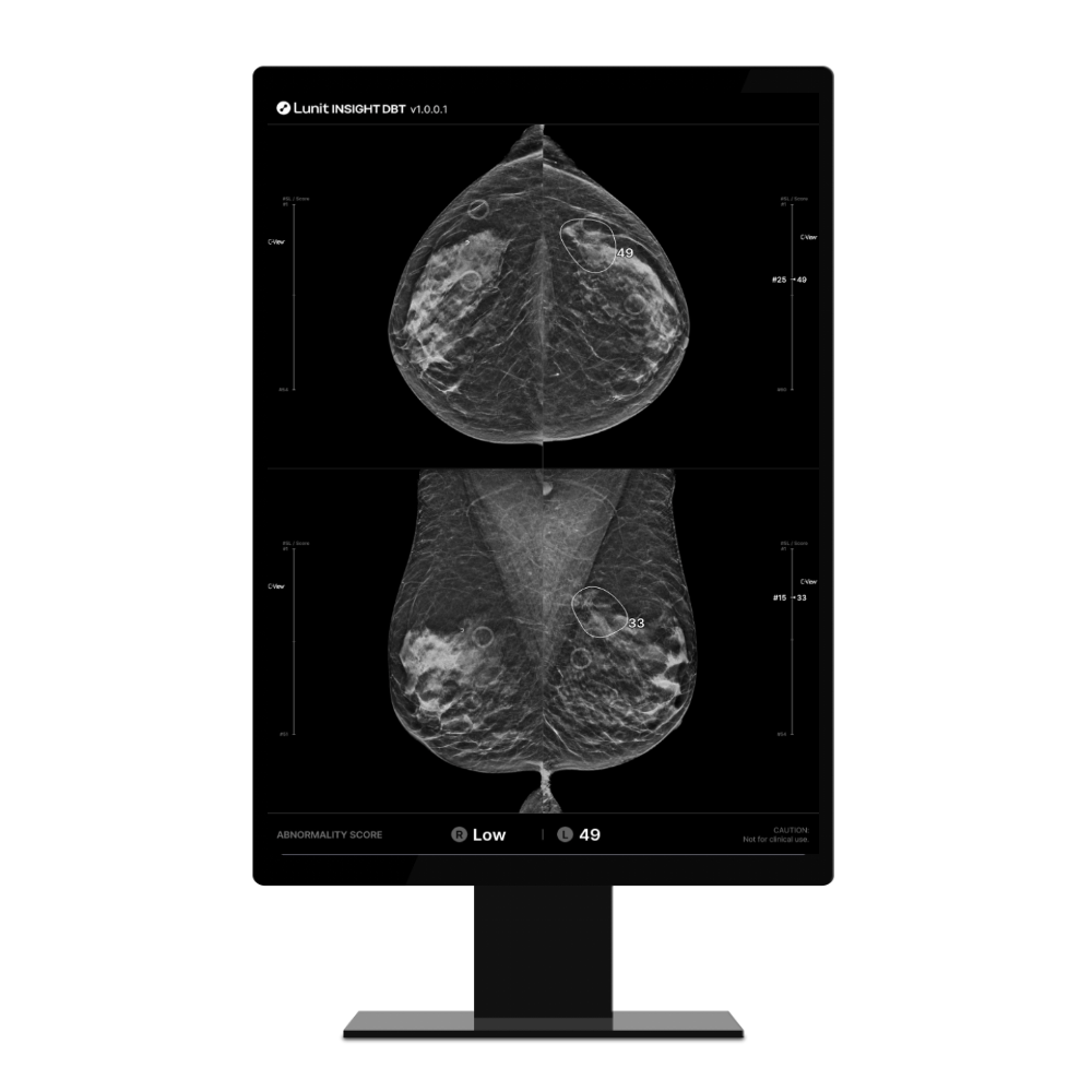 RSNA 2024_landing page_DBT-2