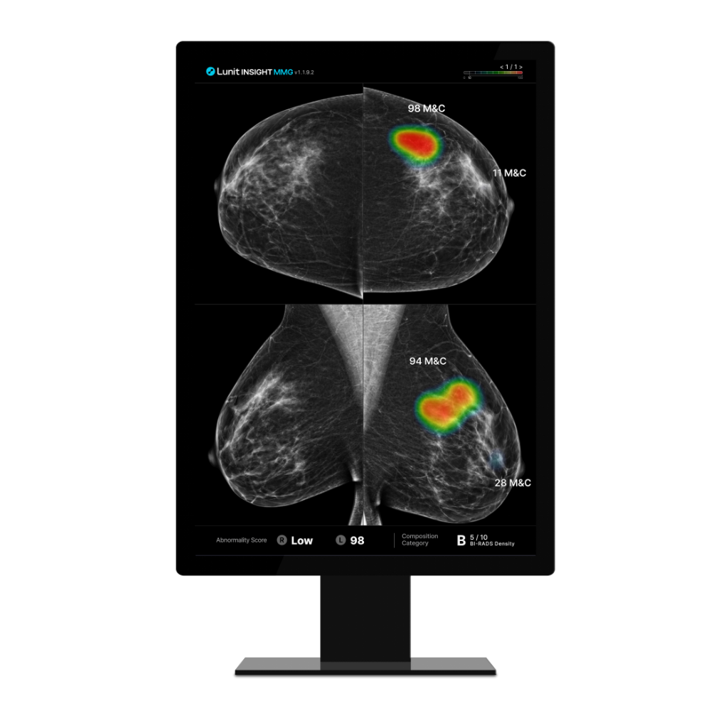 RSNA 2024_landing page_MMG