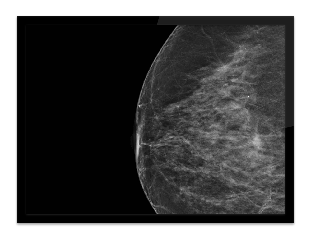 RSNA 2025 LP_Image-Based Risk